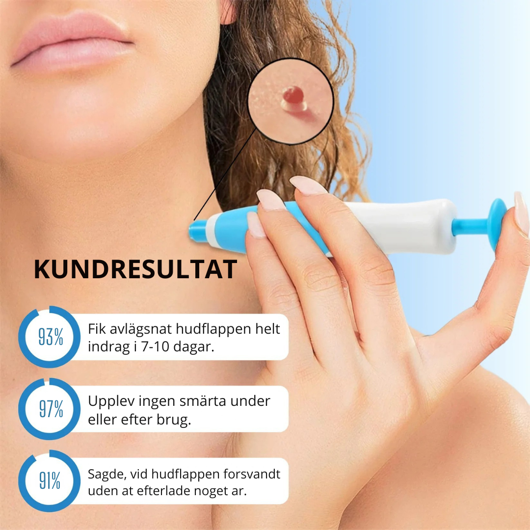 Hudlättare™ - Bärbar Sugapparat För Hud