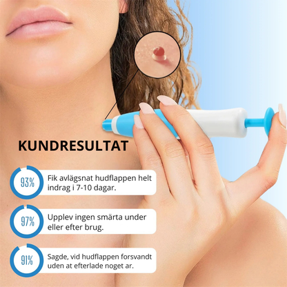 Hudlättare™ - Bärbar Sugapparat För Hud