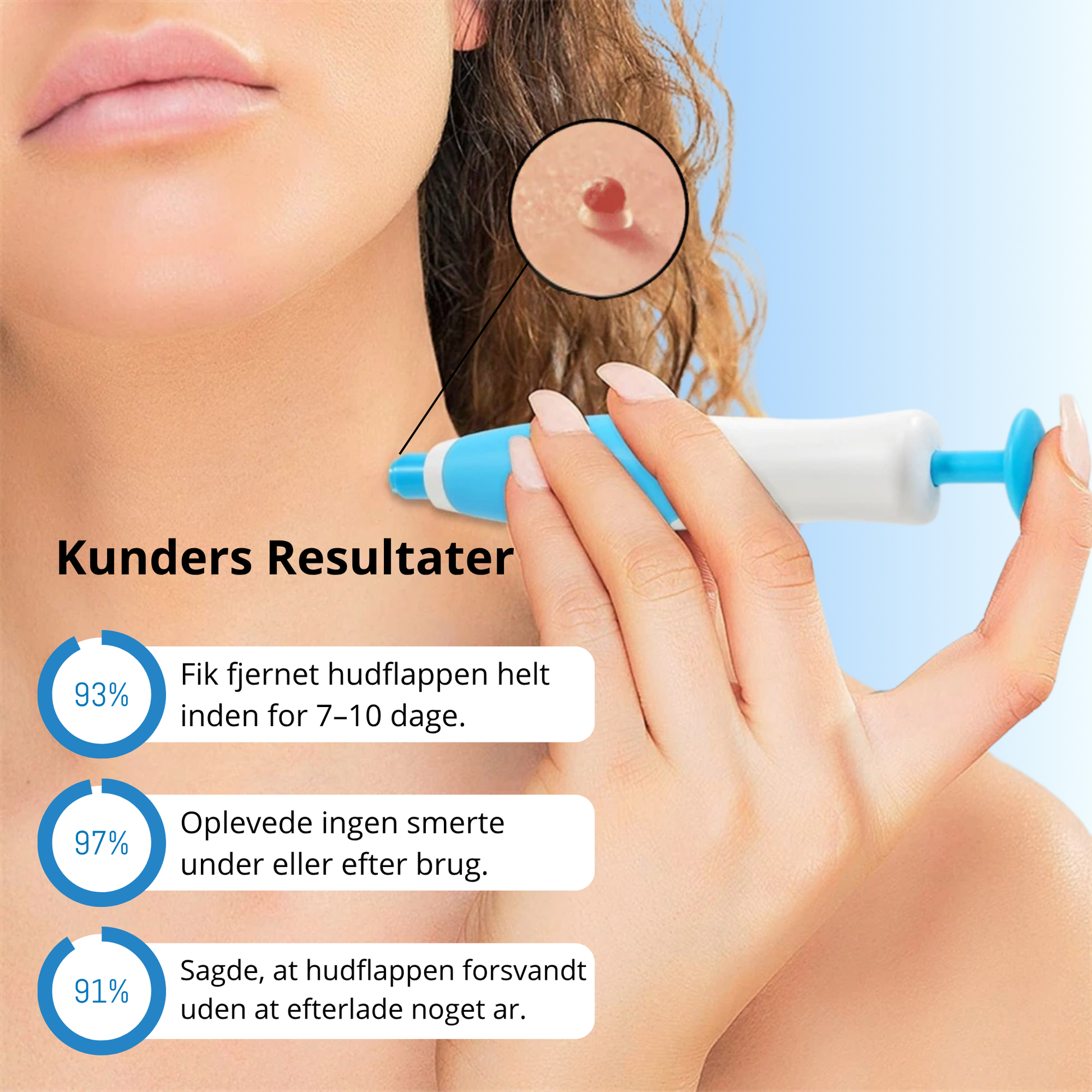 SkinLiftix™ - Elektrisk Hudfliksborttagare